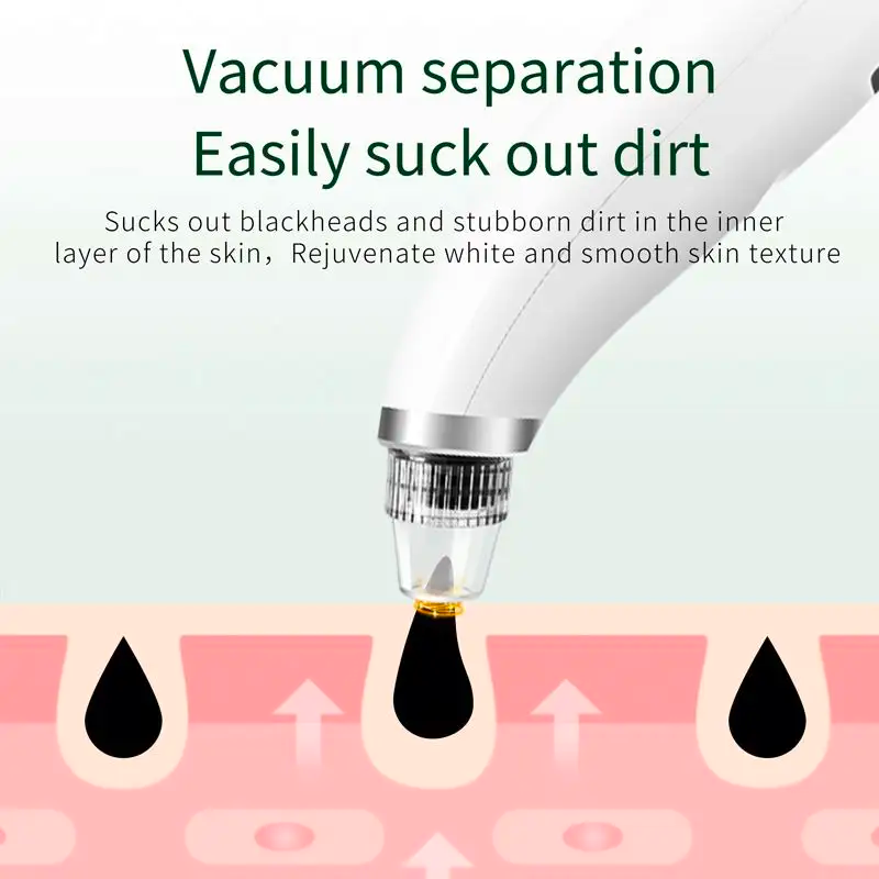 Black Head Remover Gentle Treatment to eliminate blackheads on sensitive skin