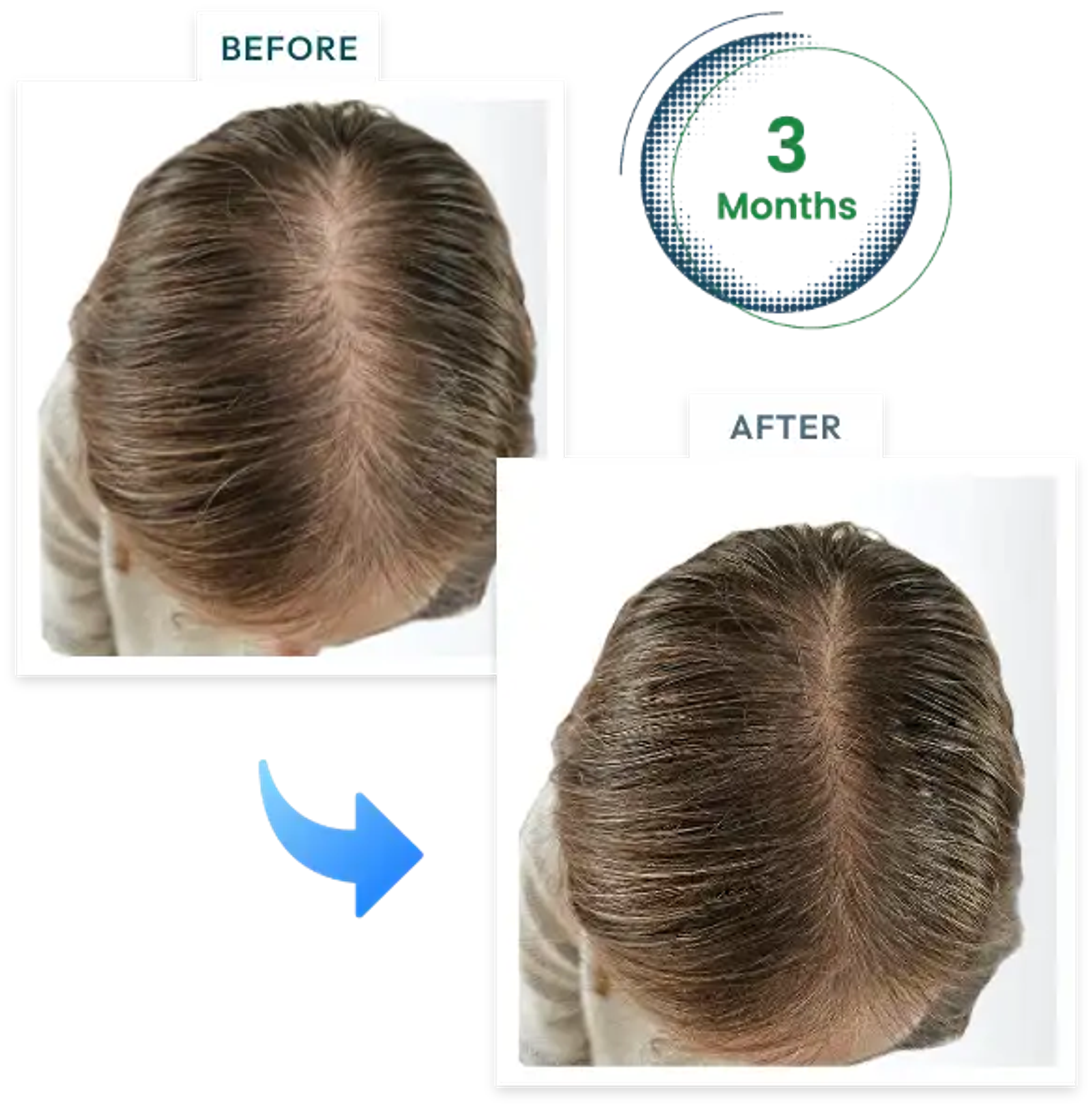 Hair assessment before and after comparison