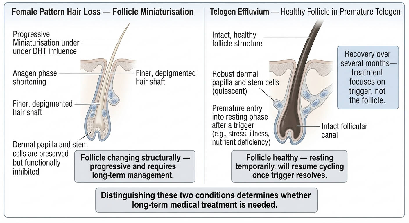 Diagram comparing female pattern hair loss vs telogen effluvium at the follicle level