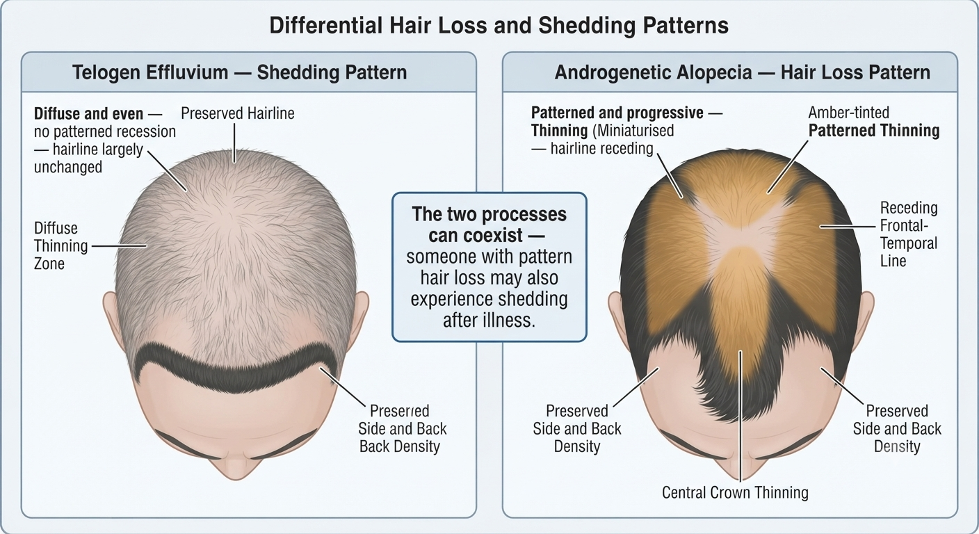 Side-by-side scalp pattern comparison for shedding vs hair loss