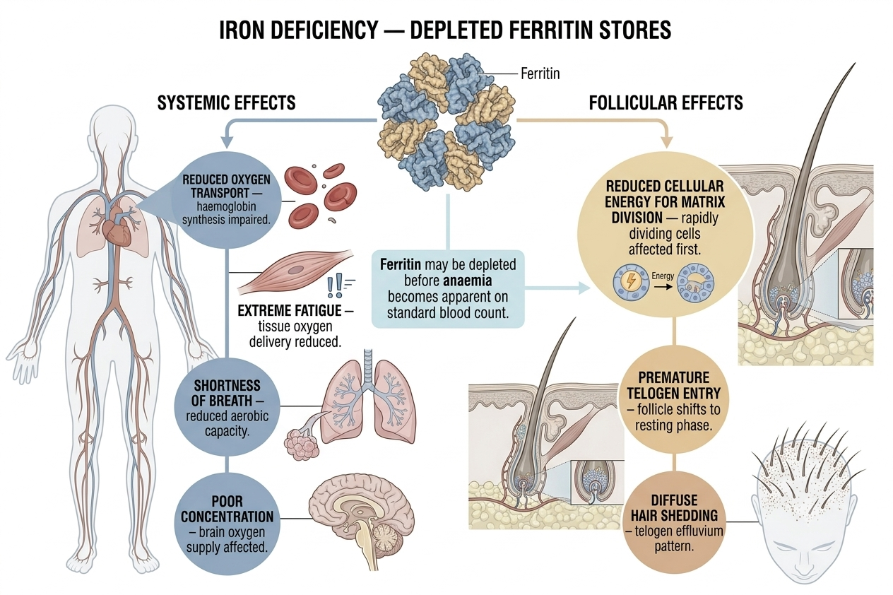 Diagram showing iron deficiency effects on follicle function and systemic symptoms