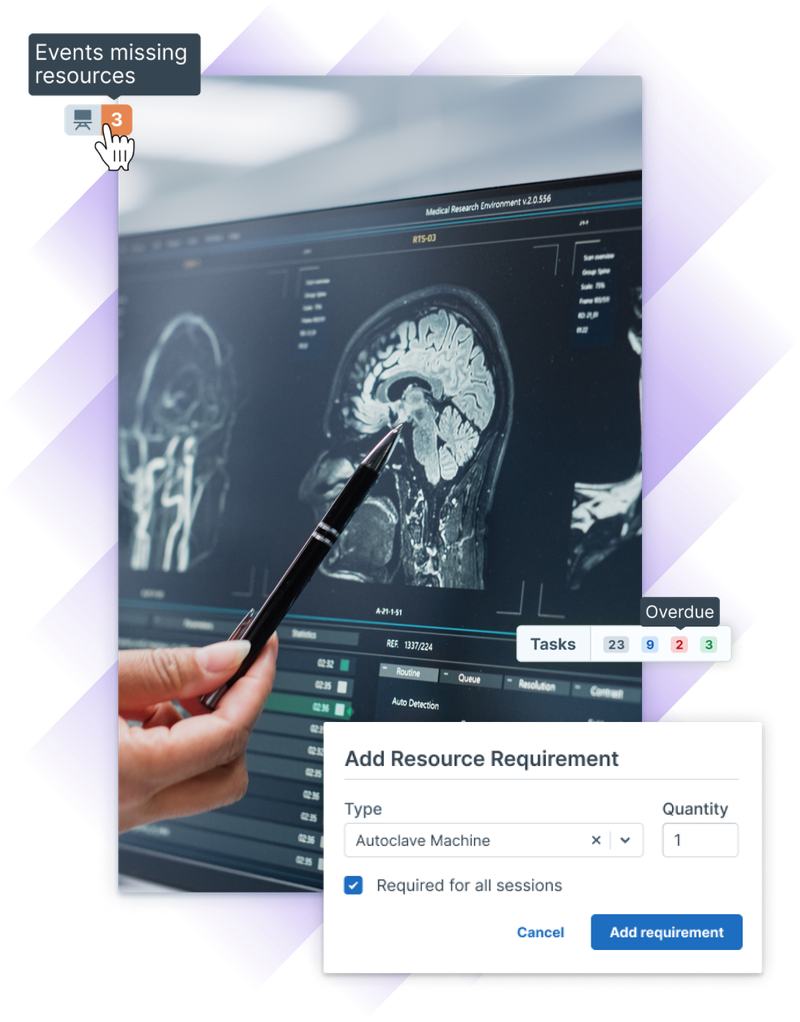 Close-up of a doctor pointing at brain MRI scans on a computer monitor during a medical analysis.