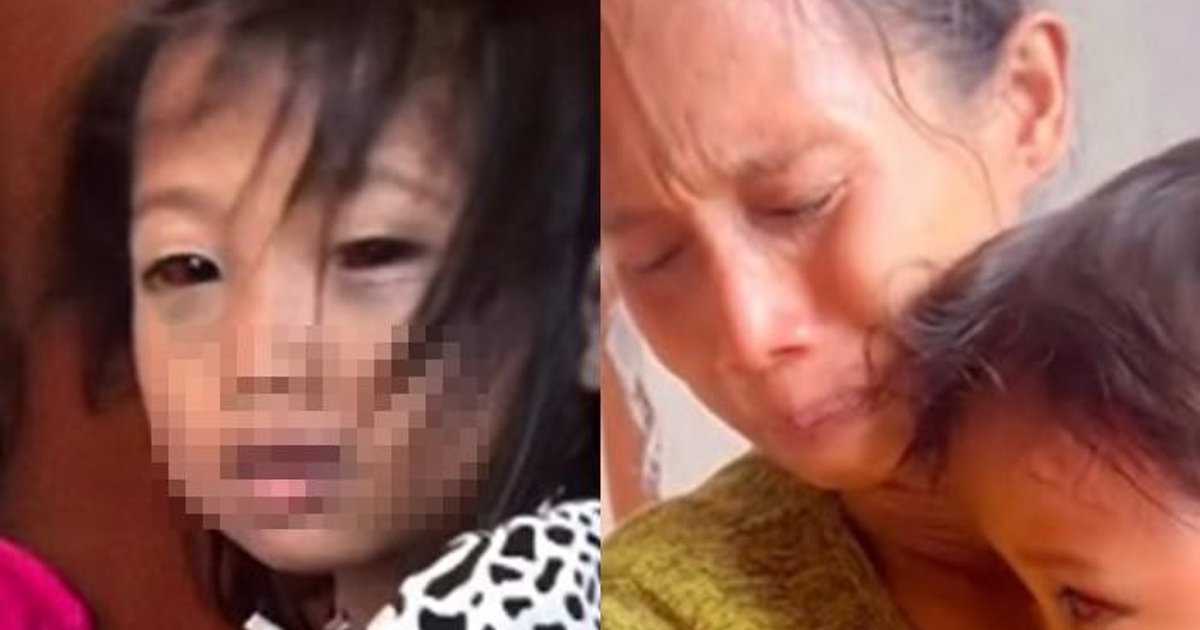 Ilustrasi artikel: Kasus Dugaan Kekerasan guru di SDN 150 Palembang, Siswi Alami Lebam di Wajah