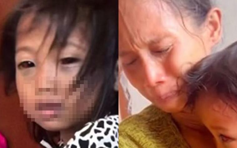 Kasus Dugaan Kekerasan guru di SDN 150 Palembang, Siswi Alami Lebam di Wajah
