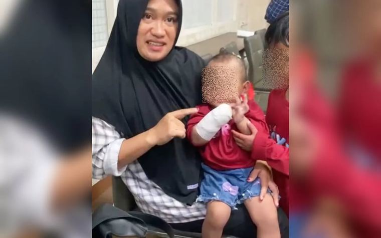 balita 15 bulan tangannya diamputasi diduga jadi korban malapraktik