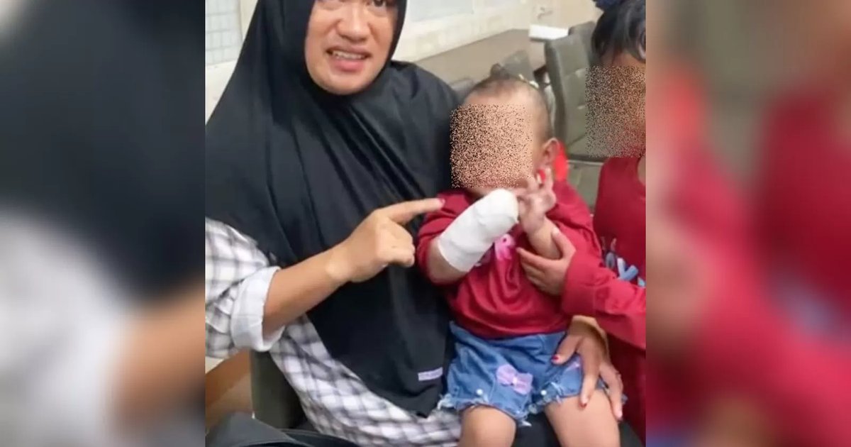 Ilustrasi artikel: balita 15 bulan tangannya diamputasi diduga jadi korban malapraktik