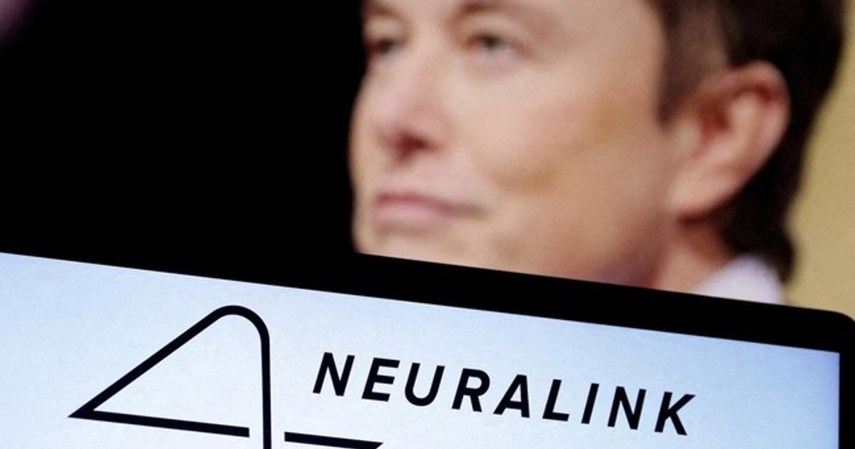 Ilustrasi artikel: Neuralink Berhasil Tanam Implan Chip di Otak Pasien Kedua