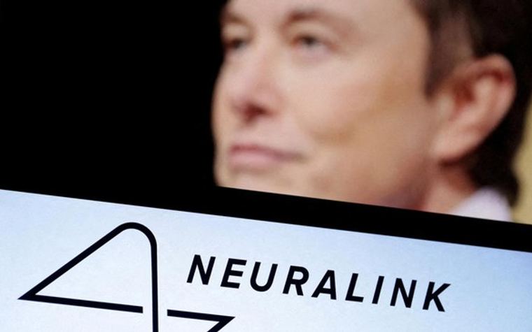 Neuralink Berhasil Tanam Implan Chip di Otak Pasien Kedua