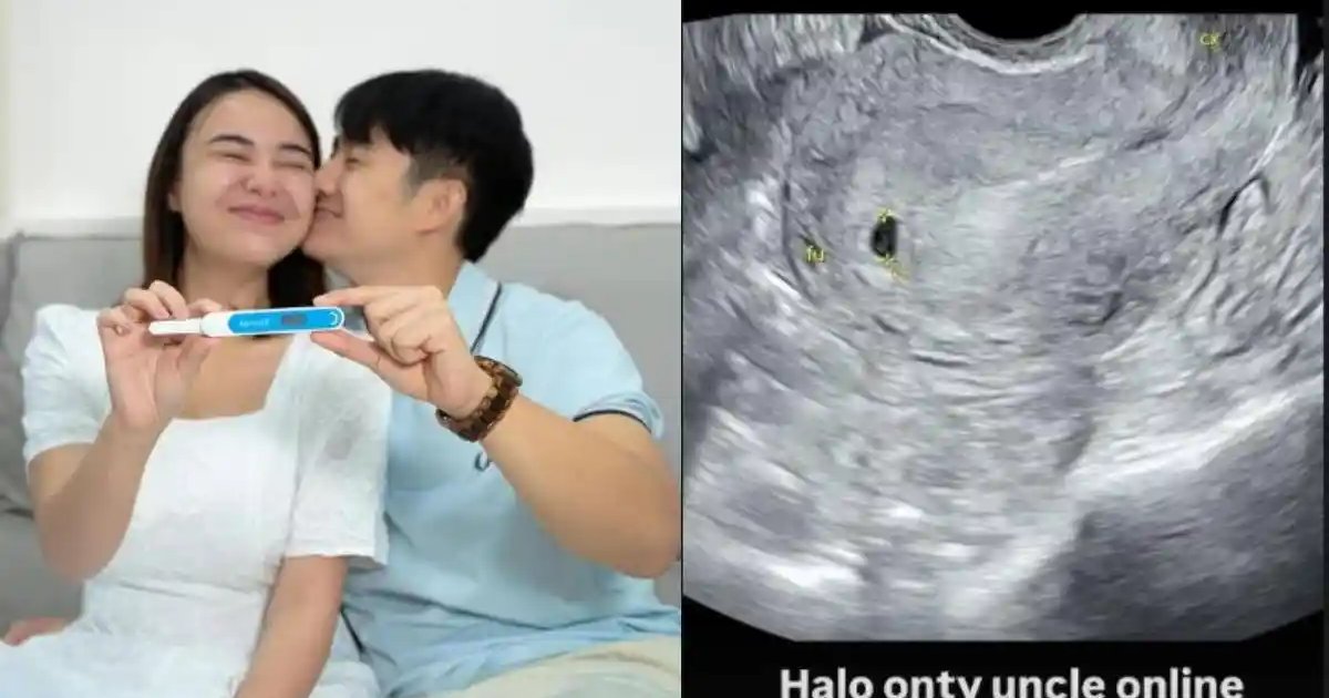 Ilustrasi artikel: Garis Dua untuk Amanda Manopo: Babak Baru akan Jadi Ibu