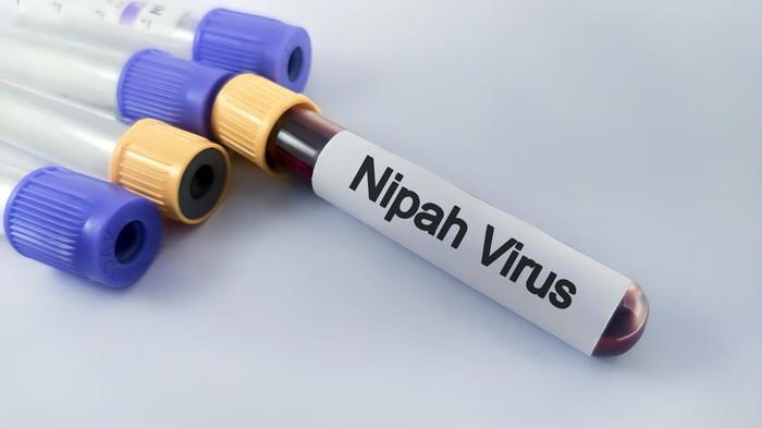 Kasus Virus Nipah di Bangladesh, Pasien Sempat Alami Demam hingga Sakit Kepala