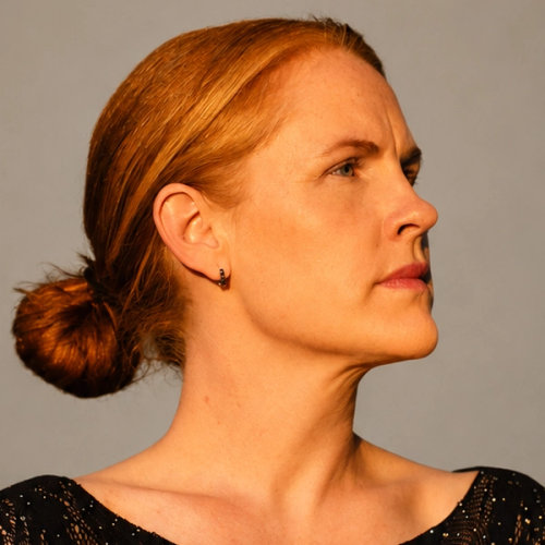 Anja Skybakmoen
