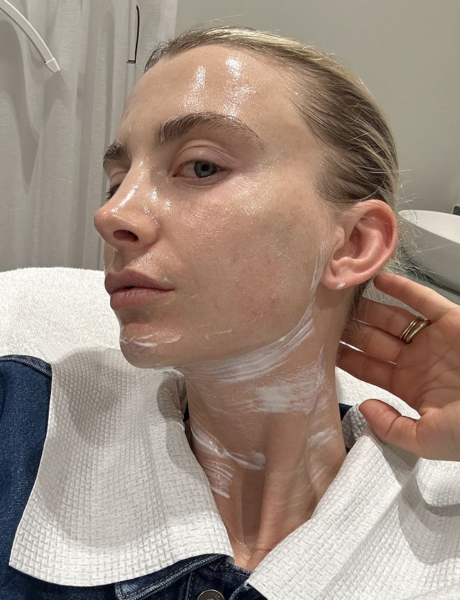 Clinic1 BBL Moxi During