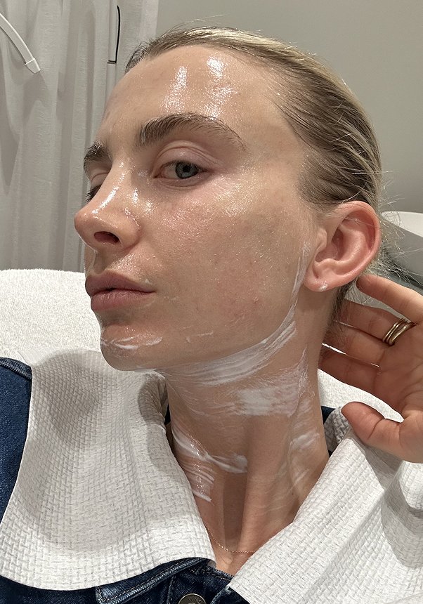 Clinic1 BBL Moxi During