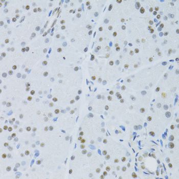 Immunohistochemistry - SNRNP70 antibody (144-06065)