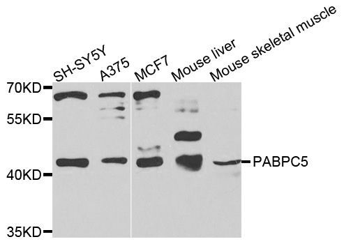 Western blot - PABPC5 antibody (144-09997)