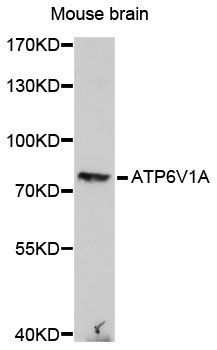 Western blot - ATP6V1A antibody (144-60756)