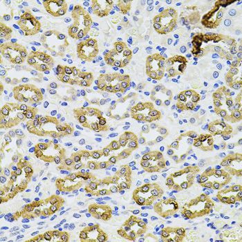 Immunohistochemistry - PIK3CA Polyclonal Antibody (144-00265)