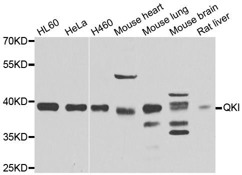 Western blot - QKI Polyclonal Antibody (144-07043)