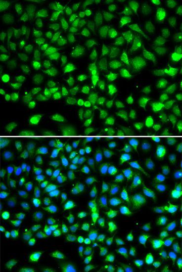 Immunofluorescence - SMYD1 Polyclonal Antibody (144-02340)