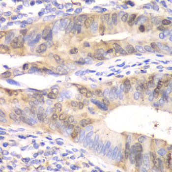 Immunohistochemistry - UBE2C Polyclonal Antibody (144-05499)