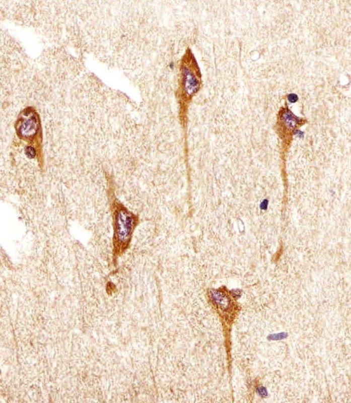 IHC-P