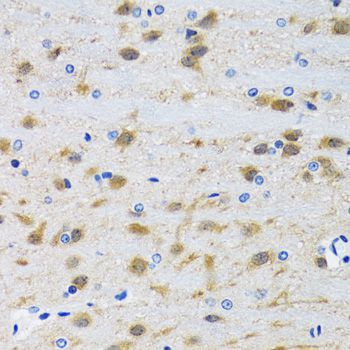 Immunohistochemistry - [KO Validated] MAPK9 Polyclonal Antibody (144-01251)