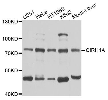Western blot - CIRH1A antibody (144-08593)