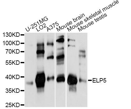 Western blot - ELP5 antibody (144-014862)