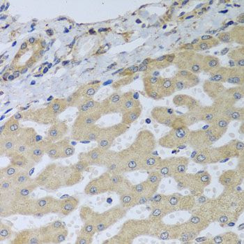 Immunohistochemistry - ATAD3B antibody (144-08268)