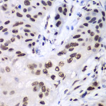 Immunohistochemistry - LIG3 antibody (144-60365)
