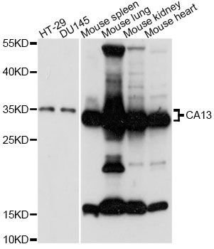 Western blot - CA13 Polyclonal Antibody (144-014467)