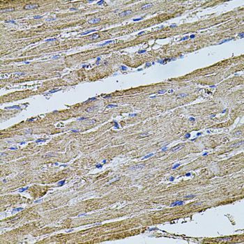 Immunohistochemistry - FLNB Polyclonal Antibody (144-02481)