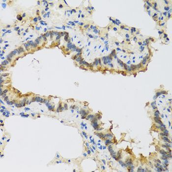 Immunohistochemistry - FAM20A antibody (144-08496)