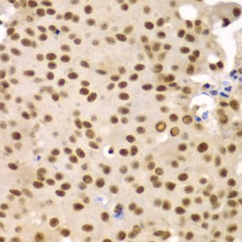 Immunohistochemistry - SF3B2 Polyclonal Antibody (144-05875)