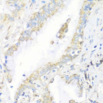 Immunohistochemistry - EIF3J Polyclonal Antibody (144-08637)