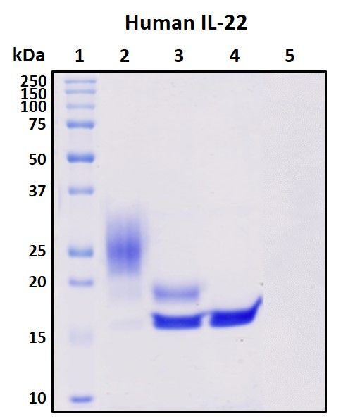 SDS-PAGE