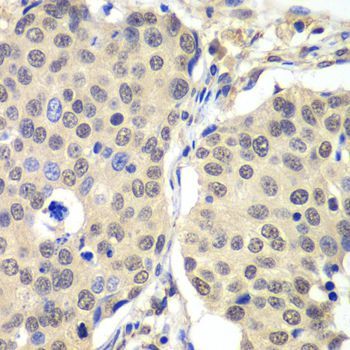 Immunohistochemistry - CCNC Polyclonal Antibody (144-06545)