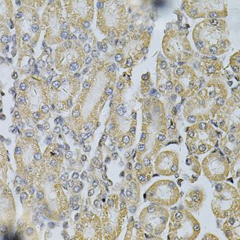 Immunohistochemistry - PDGFB Polyclonal Antibody (144-01195)
