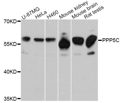Western blot - PPP5C Antibody (144-011712)