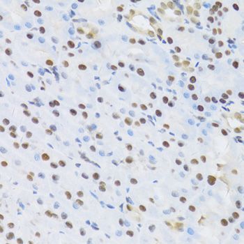 Immunohistochemistry - SFN Polyclonal Antibody (144-01026)