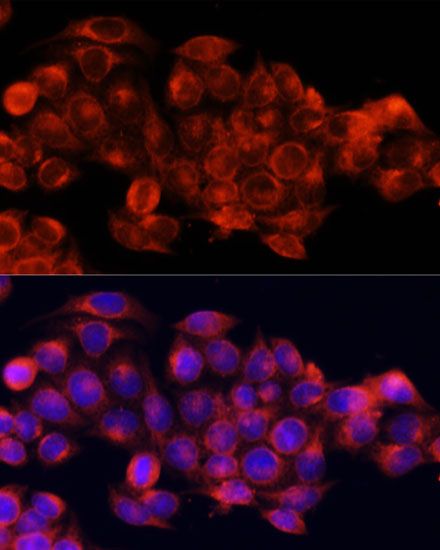 Immunofluorescence - ATG5 Polyclonal Antibody (144-00203)