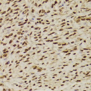 Immunohistochemistry - ANP32A Antibody (144-05768)