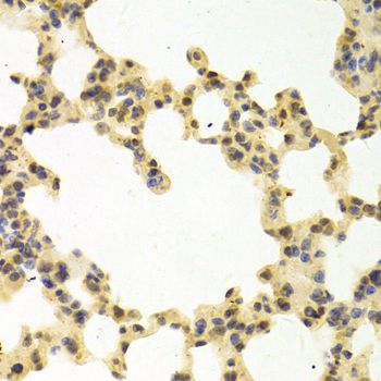 Immunohistochemistry - RANGAP1 antibody (144-05381)