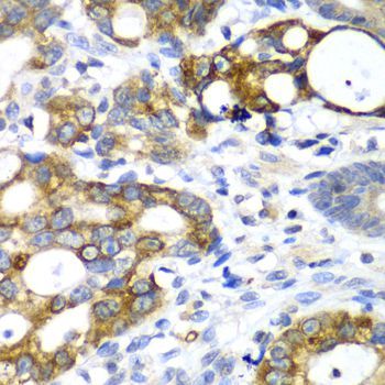 Immunohistochemistry - AMY2A antibody (144-08045)
