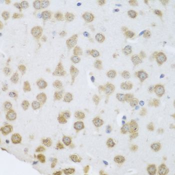 Immunohistochemistry - GRPEL2 Polyclonal Antibody (144-08339)