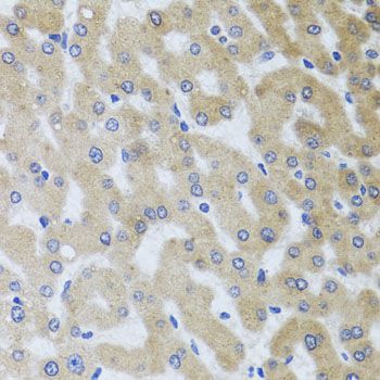 Immunohistochemistry - UVRAG antibody (144-08462)