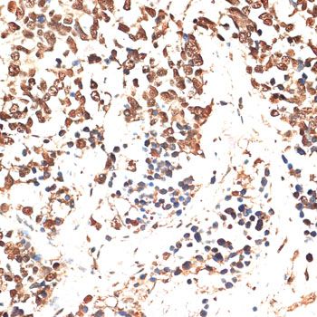 Immunohistochemistry - MCM5 antibody (144-013514)