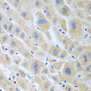 Immunohistochemistry - BLVRB antibody (144-07260)