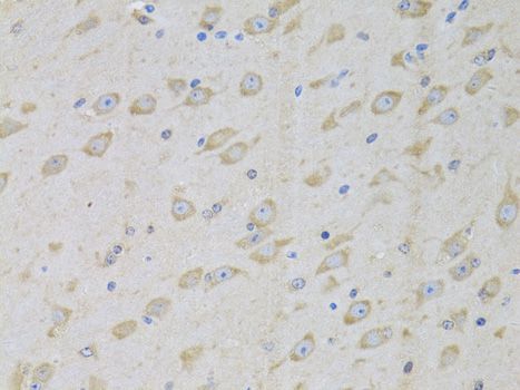 Immunohistochemistry - GARS Polyclonal Antibody (144-05435)