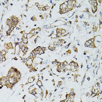 Immunohistochemistry - [KO Validated] SIRT3 Polyclonal Antibody (144-05718)